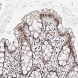 SRCAP Antibody, Novus Biologicals 25 &mu;L; Unlabeled:Antibodies, Polyclonal